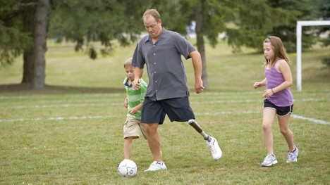 Man Having One Prosthetics Leg And Playing With Children